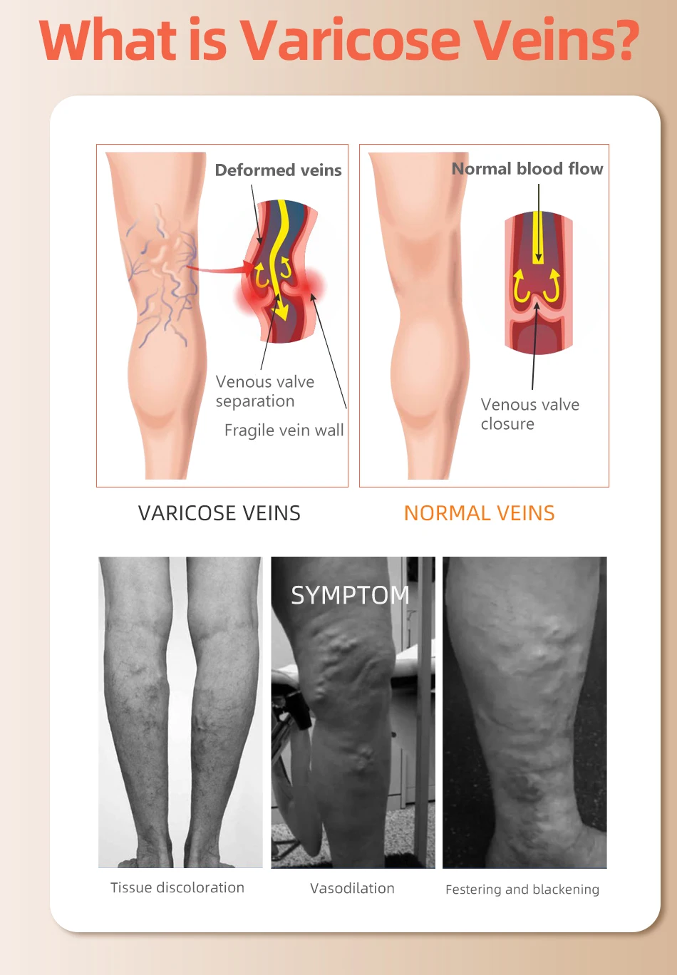 30-40 MmHg sopra il ginocchio  - Compression Sock Medical recensione e prezzo